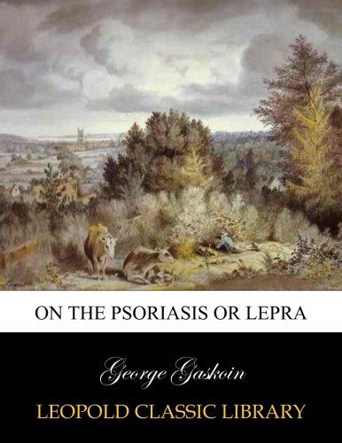 On the psoriasis or lepra